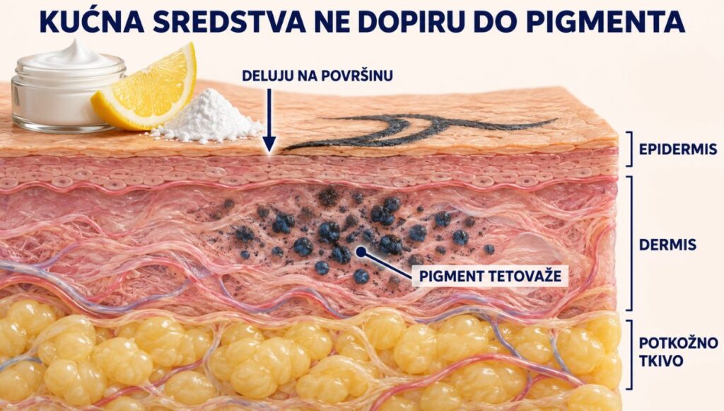 Kako kućna sredstva deluju na pigment tetovaže.